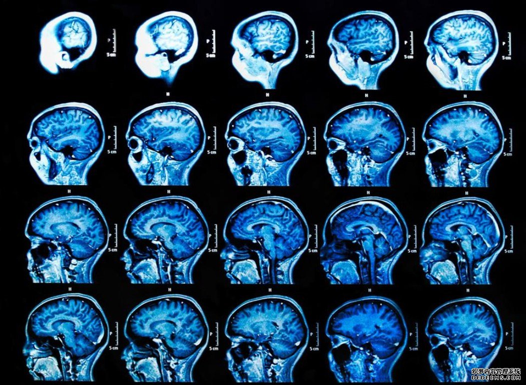 蓝冠注册:人工智能将改变医疗保健的3种方式